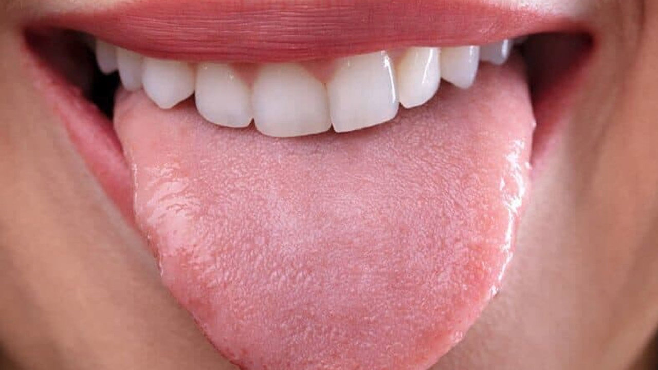 Esto es lo que indica el color de tu lengua por las mañanas