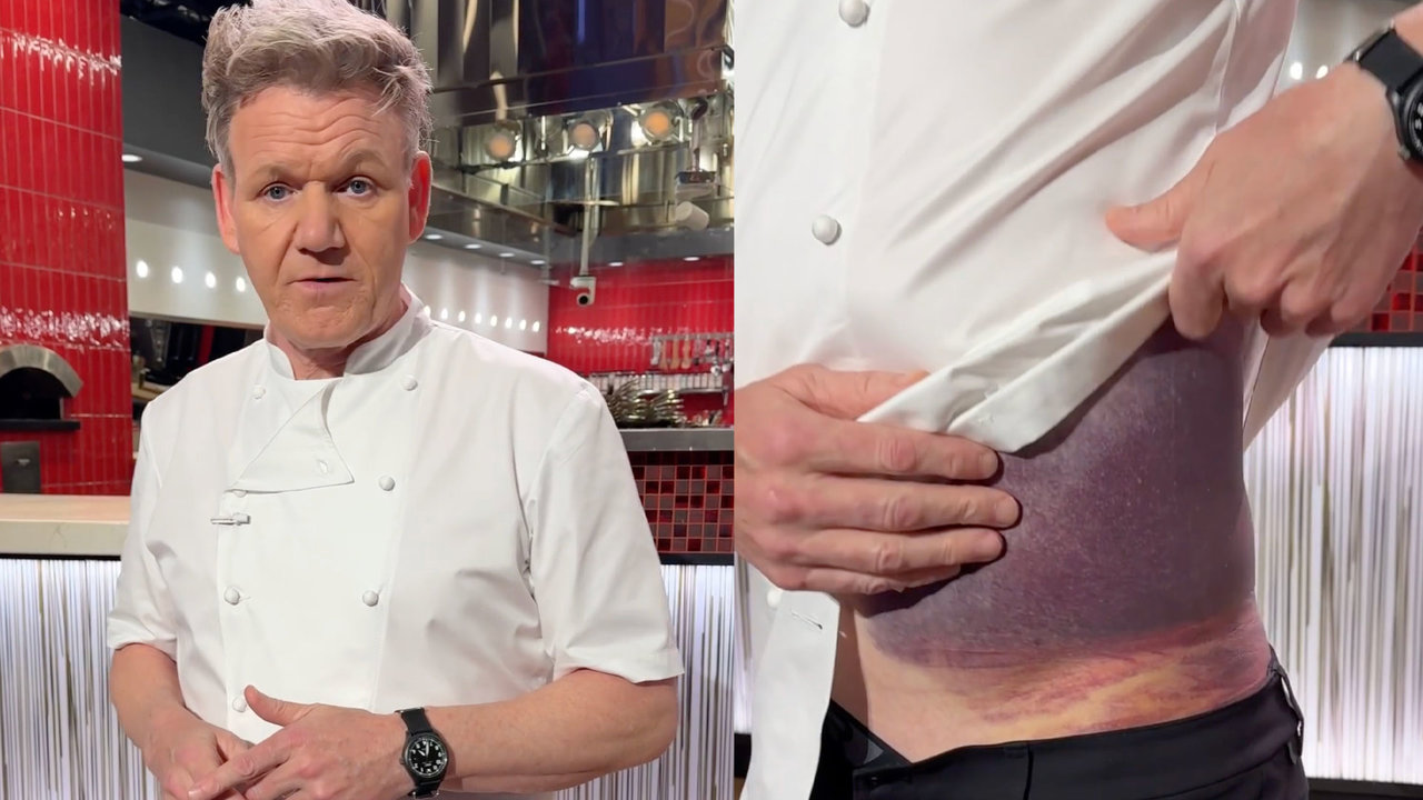 Gordon Ramsey sorprende a sus seguidores mostrando las lesiones tras un aparatoso accidente