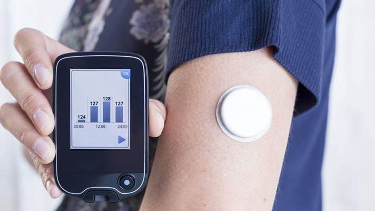 El sensor SMCG mide el nivel de glucosa en sangre de forma constante y se puede monitorizar en el móvil